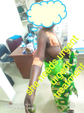 Load image into Gallery viewer, Miss Wurry Jallow - Renal Failure